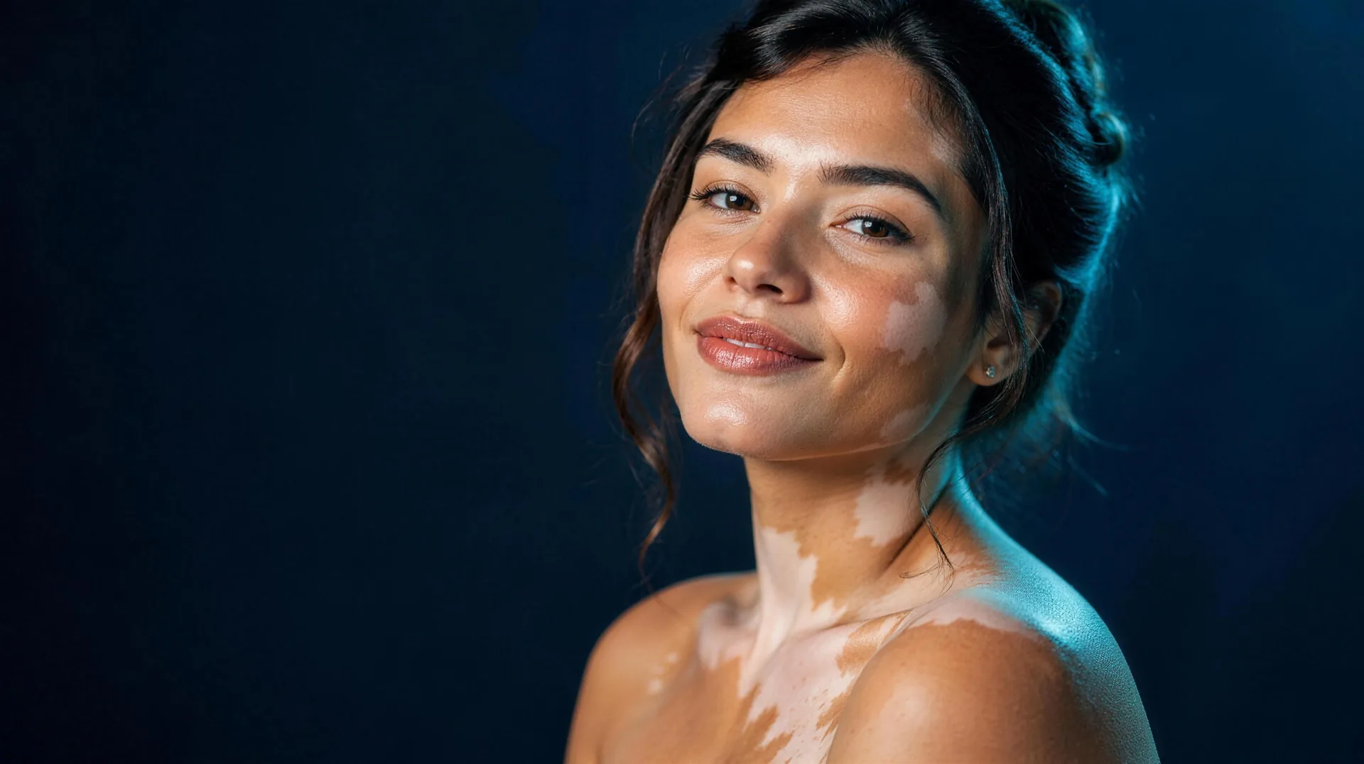 vitiligo skin condition UAE - TheKnowHow UAE