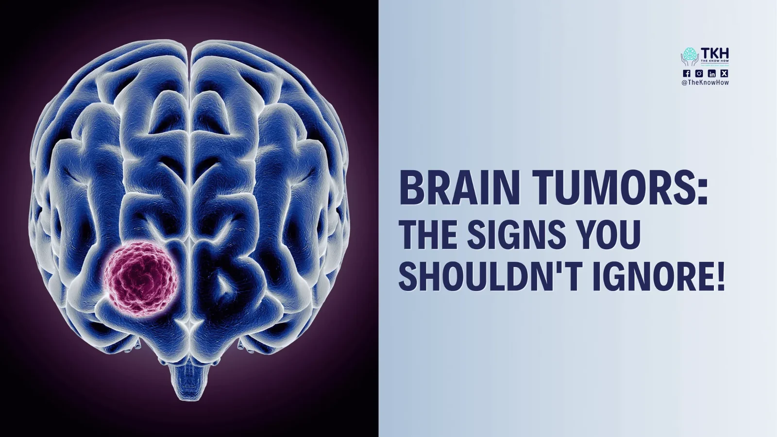Brain tumors: The signs you shouldn't ignore!