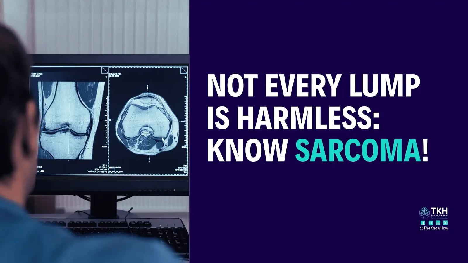 Not every lump is harmless: Know sarcoma!